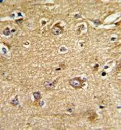 Mitofilin antibody, Internal