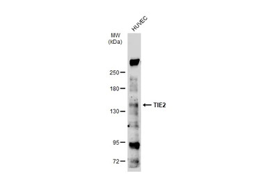 TIE2 antibody