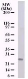 NKIRAS1 antibody [184C278]