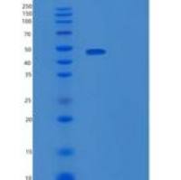 人TRAIL R3/TNFRSF10C/CD263重组蛋白C-Fc-6His