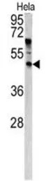 ANGPTL7 antibody, N-term