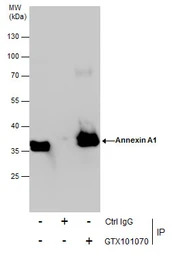 Annexin A1 antibody