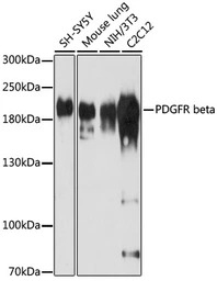 PDGF Receptor beta antibody