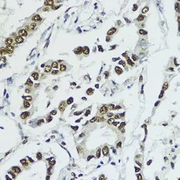 Histone H3T11ph (phospho Thr11