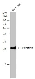 Calretinin antibody
