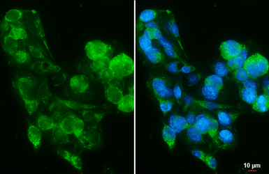 PIGR antibody [N2C1], Internal