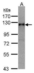 Timeless antibody [N1N2], N-te