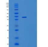 人IL-1受体辅助蛋白/IL-1RAcP/IL-1R3重组蛋白