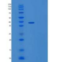 人IL-1受体辅助蛋白/IL-1RAcP/IL-1R3重组蛋白