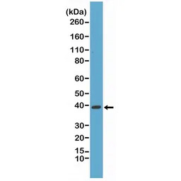 p38 MAPK antibody [RM245]