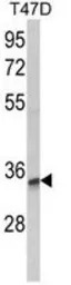 TSPAN12 antibody, C-term
