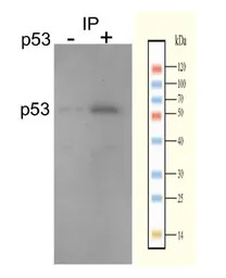 p53 antibody