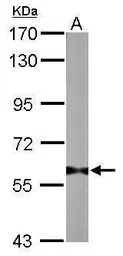 PRMT3 antibody