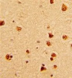 KHSRP antibody, N-term