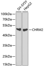 mAChR M2 antibody