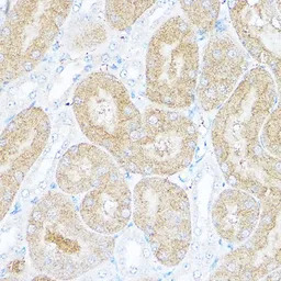 Sorbitol Dehydrogenase antibod