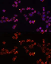 Adenine Nucleotide Translocase