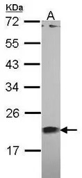 Centrin 1 antibody [N1C3]