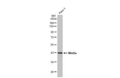 Wnt5a antibody