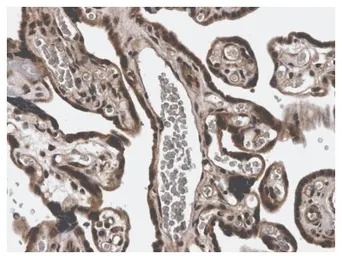 MMP3 antibody [3E44]