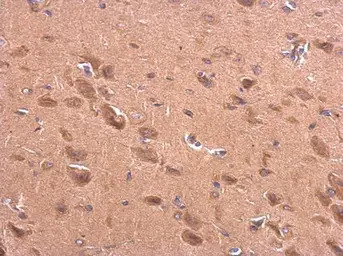 BACE2 antibody [C1C3]