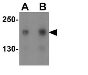 TSC2 antibody