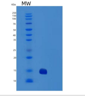 人特雷尔R2/TNFRSF10B/DR5/CD262重组蛋白