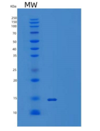 人甲状腺素运载蛋白/TTR/PALB重组蛋白C-6His