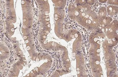 NPR-C antibody [N3C3]