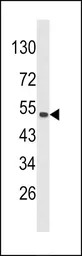 CKIP1 antibody, N-term