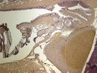 Creatine kinase (muscle) antib