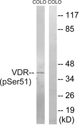 Vitamin D Receptor (phospho Se
