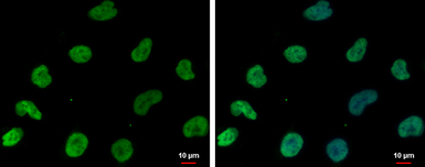 DNAJB6 antibody [N3C3]