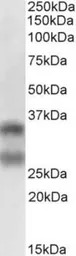 sRANKL antibody [12A668]