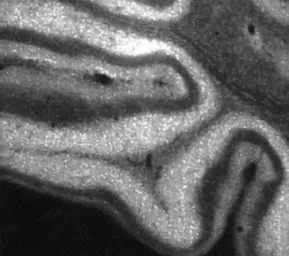 IP3 Receptor II antibody