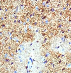 EAAT1 antibody