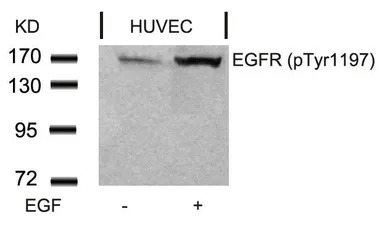 EGFR (phospho Tyr1173) antibod