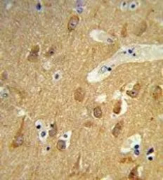 TSPAN12 antibody, C-term