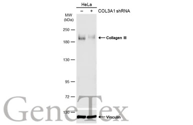 Collagen III antibody [C2C3], 