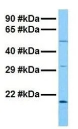 HERV-FRD antibody, N-term