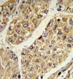 CSGALNACT2 antibody, Internal