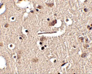 SLITRK2 antibody