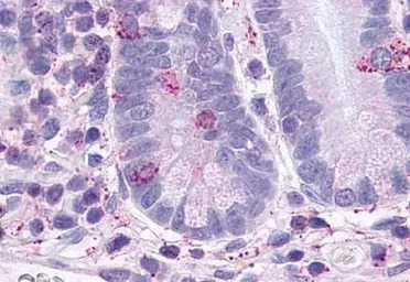 Glucagon like peptide 2 recept