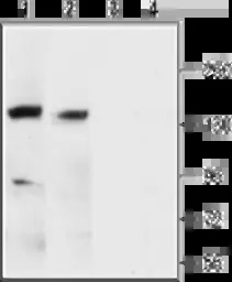 Maxi Potassium channel alpha a