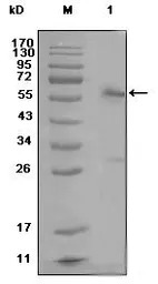 Estrogen Receptor alpha antibo