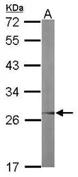 UBC3B antibody