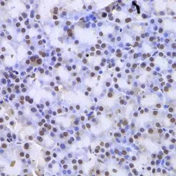 Casein Kinase 1 epsilon antibo