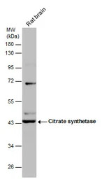 Citrate synthase antibody [GT2