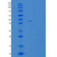 人降钙素基因相关肽2重组蛋白