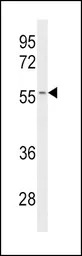 CYP2C19 antibody, Internal